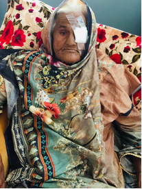 Doctor performing cataract surgery